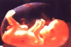 unborn.jpg